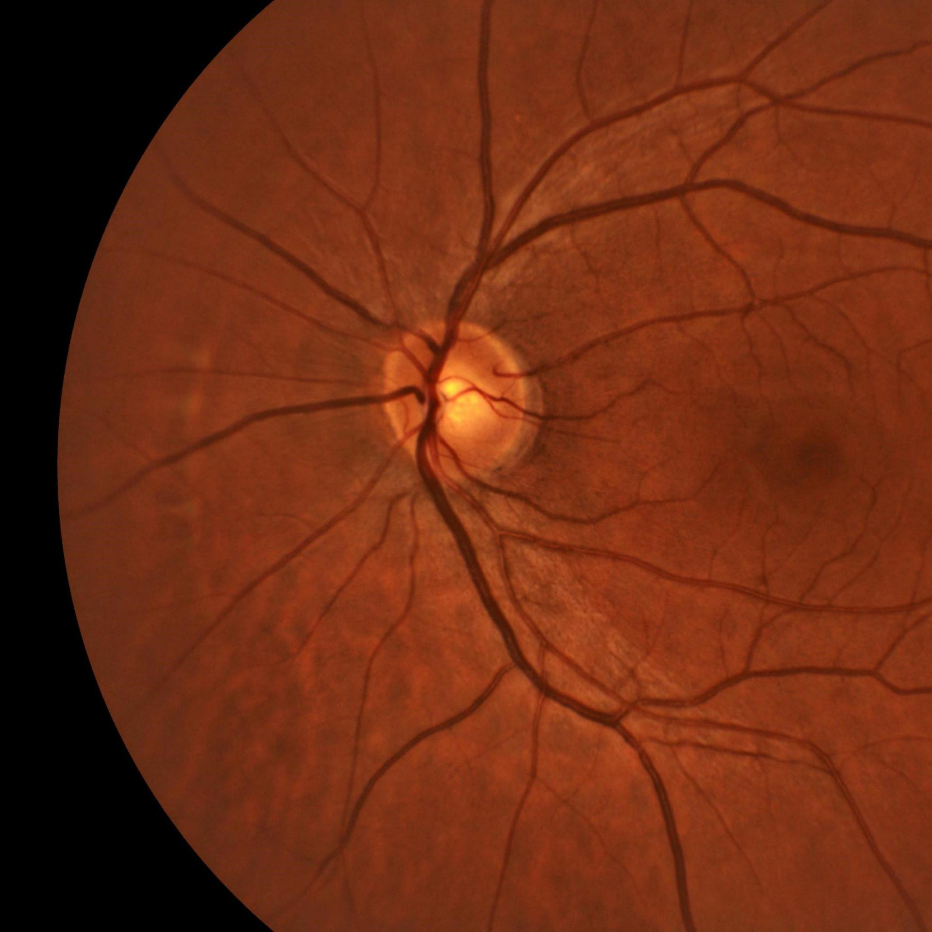 Analiza segmentului posterior.