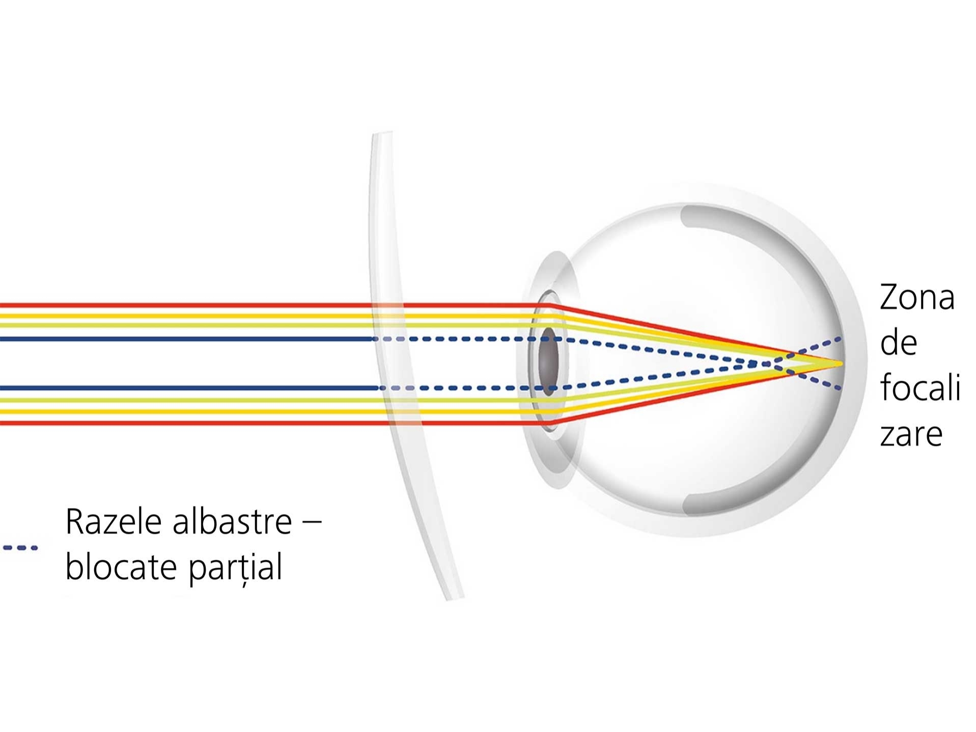 Vizualizarea modului în care tratamentul pentru lentile poate reduce strălucirea orbitoare prin blocarea parțială a razelor albastre 